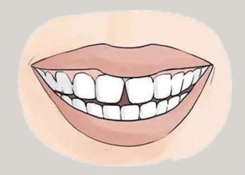 <a href=http://www.metzler.com.cn/news_article?news_id=116>一次性口腔探針</a>